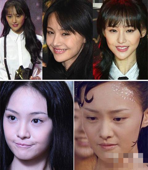女明星整容前后照片對比照片，美麗背后的故事，女明星整容前后對比照，美麗背后的故事揭秘
