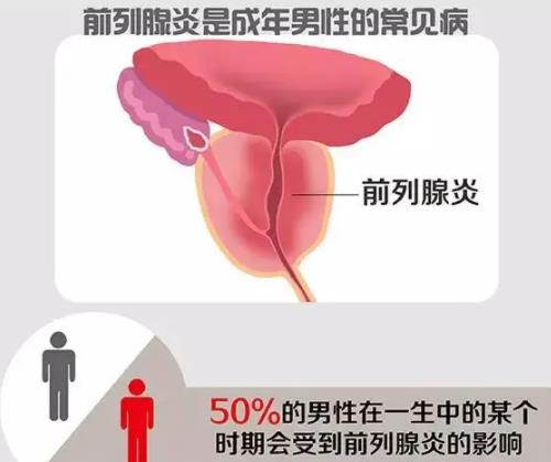 輕微的前列腺炎能自愈嗎？解析與探討，輕微前列腺炎能否自愈？解析及探討