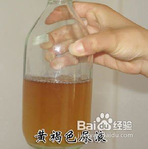 小便時尿出血的原因及應對措施，尿出血原因解析與應對措施
