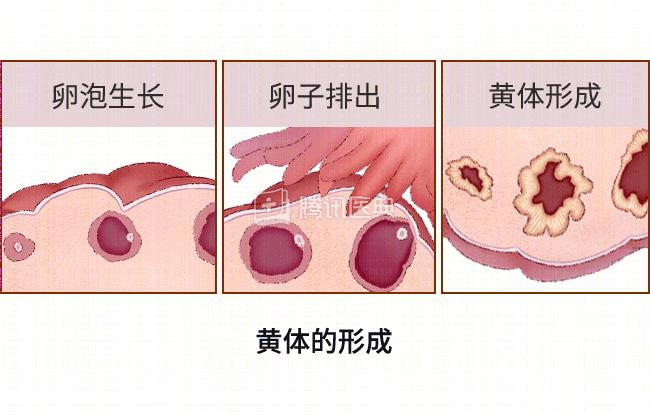 黃體破裂的早期癥狀，黃體破裂的早期癥狀概述