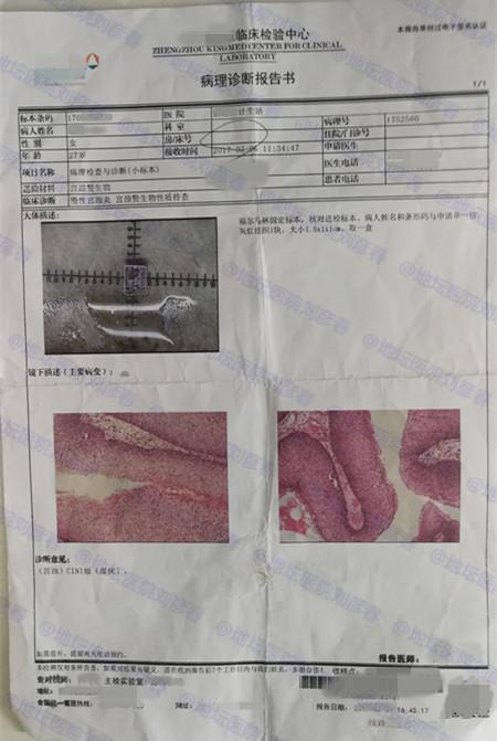 關(guān)于尖銳濕疣的治療，全面理解與科學(xué)應(yīng)對(duì)，尖銳濕疣治療，全面理解與科學(xué)應(yīng)對(duì)策略