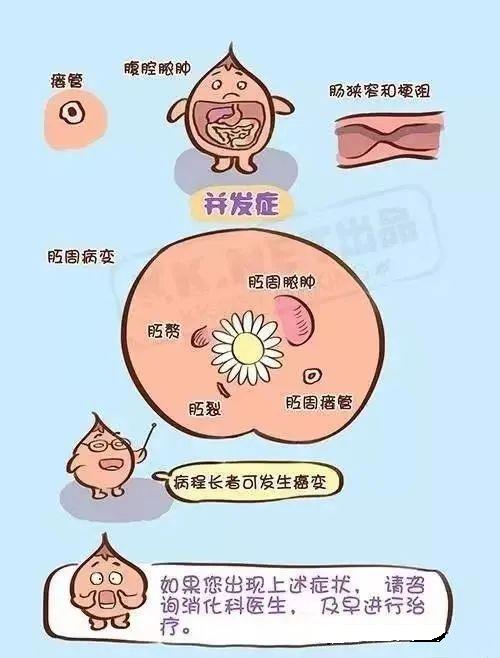 克羅恩病最常見的癥狀及其影響，克羅恩病常見癥狀及其影響概述