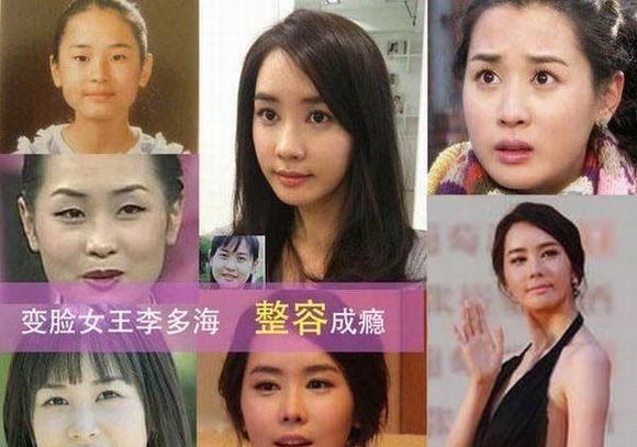 港臺(tái)明星整容失敗，探究背后的原因與教訓(xùn)，港臺(tái)明星整容失敗背后的原因與教訓(xùn)探究