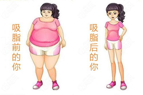 哈爾濱吸脂手術(shù)的專業(yè)醫(yī)療機(jī)構(gòu)解析，哈爾濱專業(yè)醫(yī)療機(jī)構(gòu)解析，吸脂手術(shù)詳解