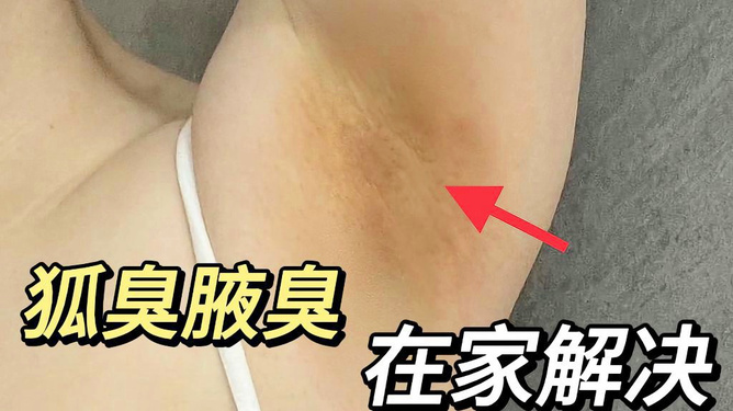 腋下異味與狐臭的判斷，如何準(zhǔn)確識別腋下異味是否為狐臭？，腋下異味與狐臭的識別，如何準(zhǔn)確區(qū)分腋下異味是否為狐臭？