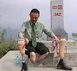 丁曉兵斷臂照片背后的故事與拍攝者揭秘，丁曉兵斷臂照片背后的故事，揭秘拍攝幕后與英雄傳奇