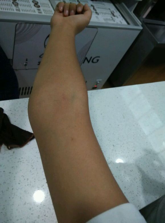 肘外翻20度，兵檢過(guò)了，挑戰(zhàn)與機(jī)遇并存，肘外翻20度，兵檢通過(guò)的挑戰(zhàn)與機(jī)遇并存之路